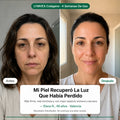 Lymvex Collagen™ | Tu Rutina de Belleza, en una Cápsula · 90 Capsulas 7